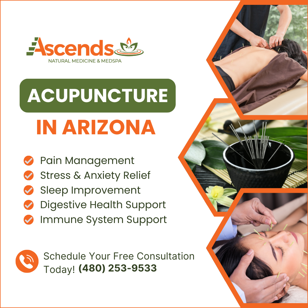 Acupuncture services in Arizona for wellness support.