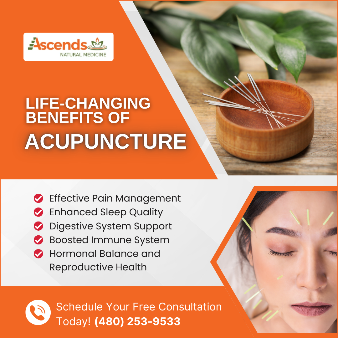 Acupuncture benefits for health and wellness consultation.