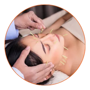 acupuncture gilbert acupuncture gilbert